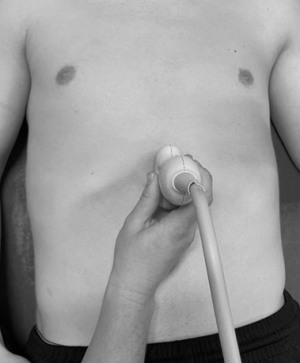 Schallkopfposition in der Medianlinie: Aorta